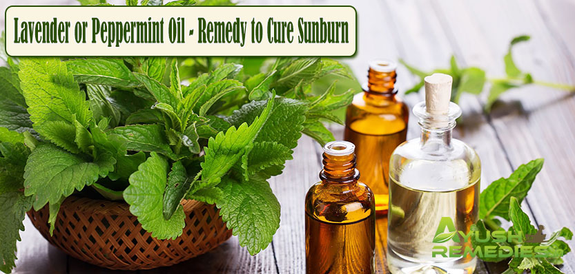 Lavender or Peppermint Oil Remedy to Cure Sunburn