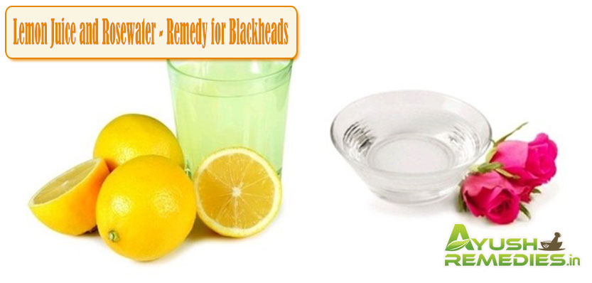 Lemon Juice and Rosewater Remedy for Blackheads1