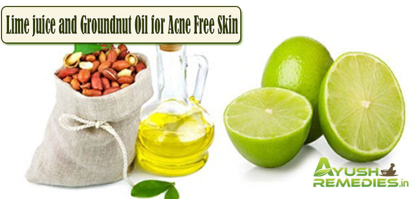 Lime Juice and Groundnut Oil for Acne Free Skin