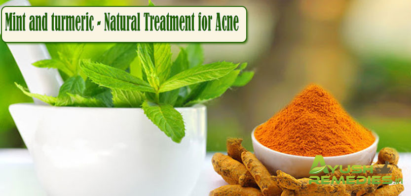 Mint and Turmeric Natural Treatment for Acne