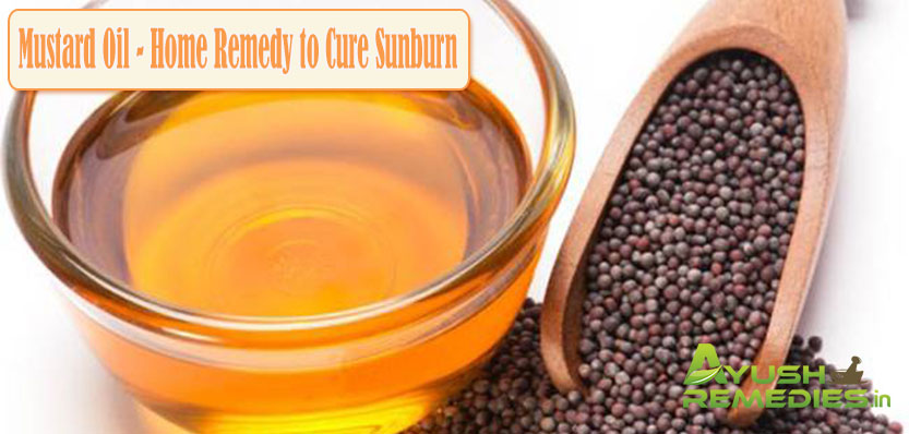 Mustard Oil Home Remedy to Cure Sunburn