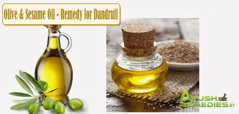 Olive and Sesame Oil Remedy for Dandruff