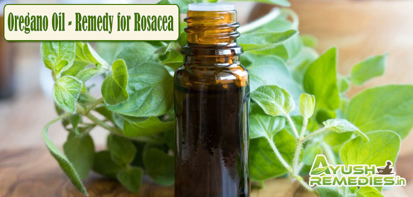 Oregano Oil Remedy for Rosacea