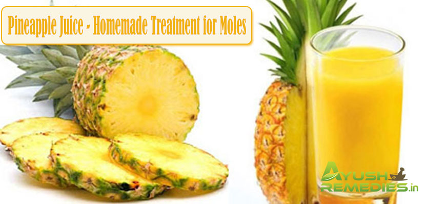 Pineapple Juice Homemade Treatment for Moles