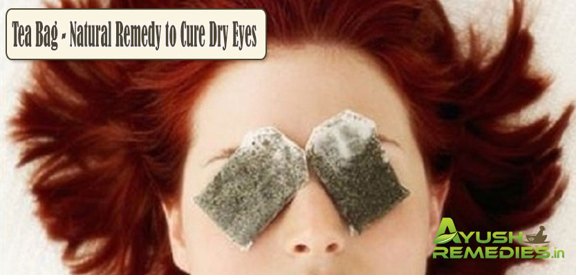 Tea Bag Natural Remedy to Cure Dry Eyes