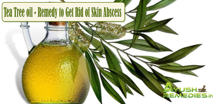 Tea Tree Oil Remedy to Get Rid of Skin Abscess