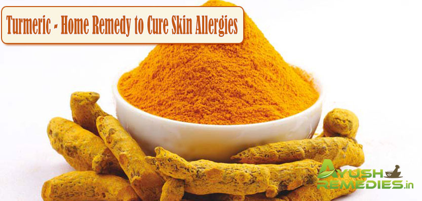 Turmeric Home Remedy to Cure Skin Allergies