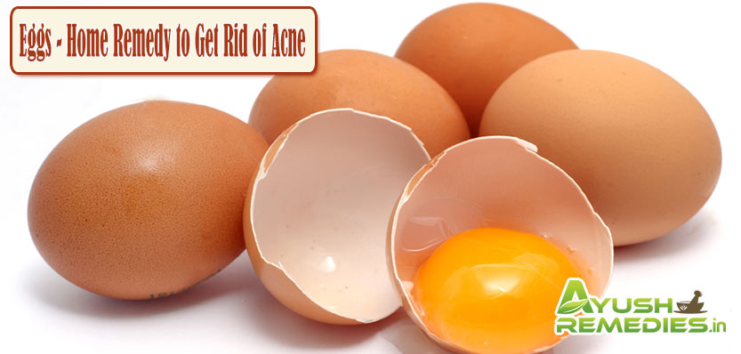 Eggs Home Remedy to Get Rid of Acne