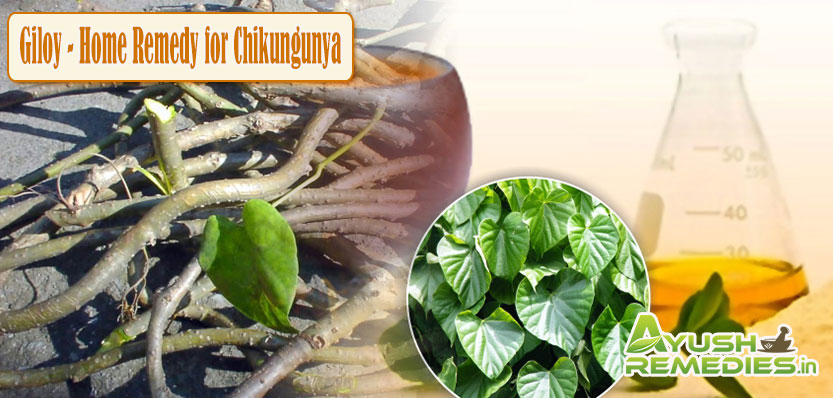 Giloy Home Remedy for Chikungunya