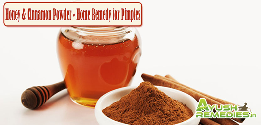 Honey and Cinnamon Powder Home Remedy for Pimples