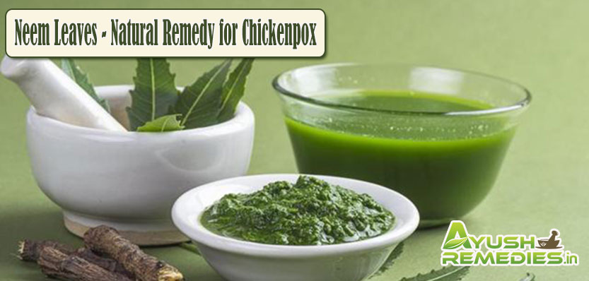 Neem Leaves Remedy for Chickenpox