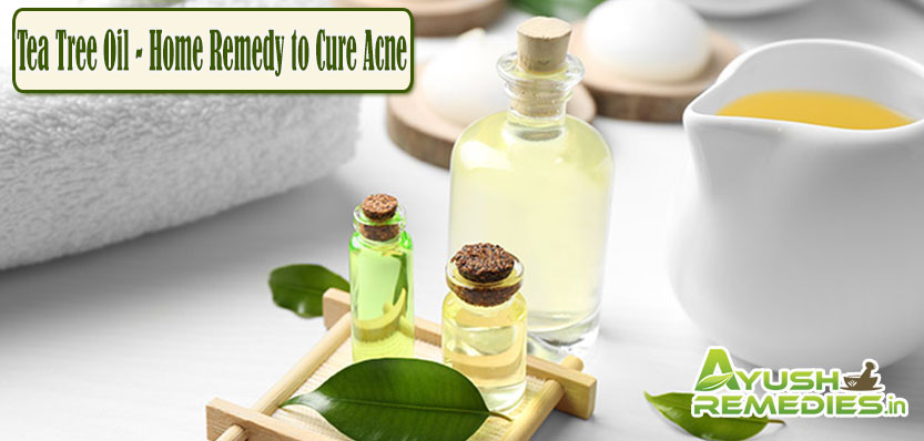 Tea Tree Oil Home Remedy to Cure Acne